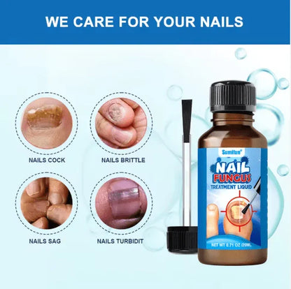 Sumifun - Nail Fungus Treatment Liquid
